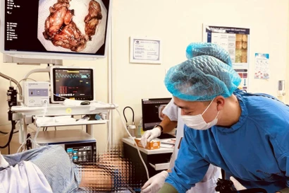 Kĩ thuật cao xử lí triệt để khối u kích thước lớn