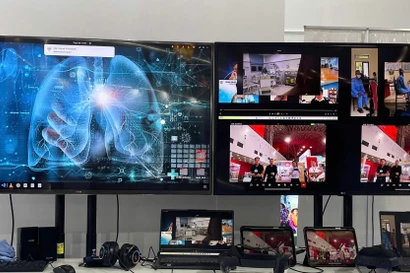 Sức mạnh của AI trong chẩn đoán sớm ung thư phổi