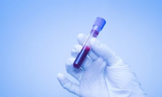 Chỉ cần xét nghiệm máu có thể phát hiện sớm bệnh ung thư? 