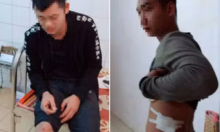 Lái và phụ xe khách Tú Hùng bị côn đồ bắn trọng thương