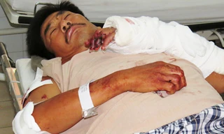 Ông Phạm Văn Tâm tại Khoa Cấp cứu Bệnh viện đa khoa tỉnh Khánh Hòa