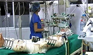 Một chiến sĩ bị thương trong vụ máy bay Mi 171 rơi đang điều trị tại Viện bỏng quốc gia. Ảnh: D. Thu (Báo Người Lao Động)