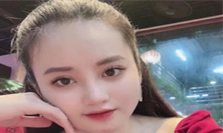 Nguyễn Thị Trang bị bắt khi vừa phẫu thuật thẩm mỹ - Ảnh: Công an cung cấp