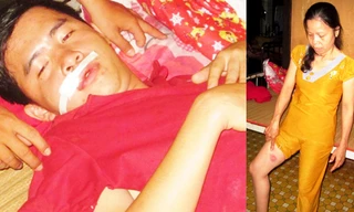 Anh Giang bị trọng thương ở mặt đang điều trị ở bệnh viện và vết thương ở đùi của bà Thuỷ sau khi bị Phó trưởng công an xã bắn