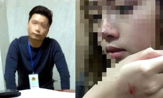 Chị P.H.V bị nhiều vết thương khi Đỗ Mạnh Hùng thực hiện hành vi sàm sỡ