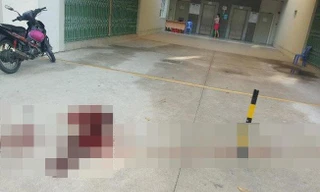 Bị chém gần đứt lìa tay khi đến nhà bạn chơi