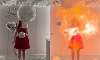 Sinh nhật kinh hoàng của cô gái Hà Nội: Bóng bay phát nổ, lửa trùm kín mặt