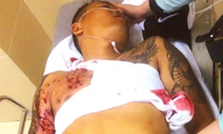 Nạn nhân lúc được đưa đi cấp cứu