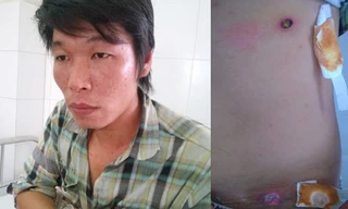 Anh Khảm trình bày sự việc và vết thương do công an thị trấn Đầm Dơi bắn. Ảnh: Dân Việt