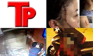 Bản tin Hình sự: Vi sao cô gái 18 tuổi bị bạn rạch mặt, khâu 60 mũi?