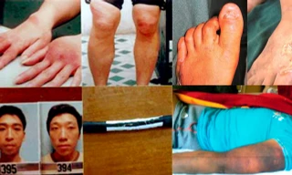 Những vụ dùng 'nhục hình' dã man như thời trung cổ