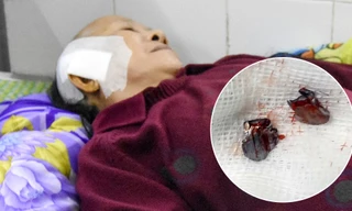 Đạn găm trúng đầu người phụ nữ