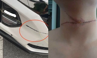 Kinh hãi khi dây diều 'sắc như dao' cứa đứt cản trước ô tô ở Hà Nội