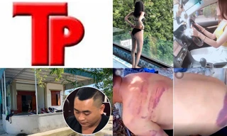 Bản tin Hình sự: Công an bị 9X đuổi chém đứt gân, mẻ xương