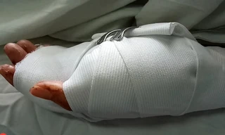 Đưa người đi cấp cứu sau hỗn chiến, thanh niên bị chém đứt cổ tay