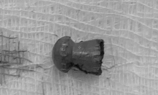 Đang làm lúa ngoài đồng, nam thanh niên bất ngờ bị đạn lạc xuyên 'của quý'