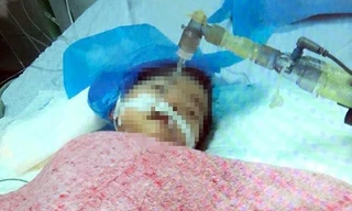 Bé gái 8 tháng tuổi đã tử vong do tiêm nhầm