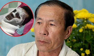 Vụ tạt axit, cắt gân chân Việt kiều: Bất ngờ lời kể của cha nạn nhân