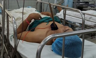 Bệnh nhân Bùi Thiện Thắng và mũi tên ngay dưới cổ đang chờ được phẫu thuật trong bệnh viện