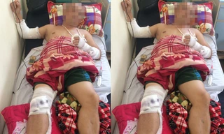 Anh Yên bị chém gục tại quán ăn đang được điều trị tại bệnh viện