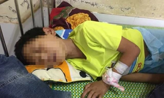 Bé trai 11 tuổi hôn mê sâu sau khi uống hết hơn một lít rượu