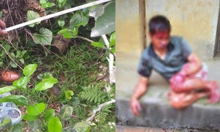 Hiện trường vụ việc và nạn nhân