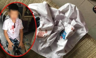 Em N.G.K. sau khi bị Đức hành hung. Ảnh: Hóng biến Hòa Bình