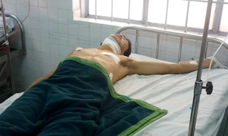 Linh đang được cấp cứu. Ảnh: Hoàng Trường