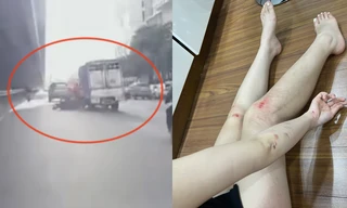 Cô gái Hà Nội kể phút bị xe tải đe dọa 'mày tin tao đâm không' rồi húc ngã