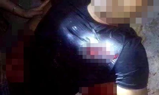 Lái xe Tuân và vết đạn xuyên ngực trái dẫn đến tử vong