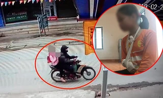 Cháu V.N.Q. bị rạn tay phải trong khi Nguyễn Trọng Trình thực hiện hành vi xâm hại tình dục