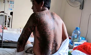 Ông Hà hứng trọn ca axit của hai kẻ lạ mặt