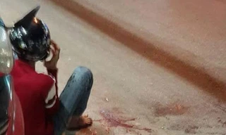 Điều tra vụ một giám đốc bị chém lìa tay