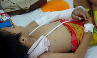 Mẹ cháu bé lo lắng và bức xúc trước tình trạng hoại tử cánh tay của con trai mình