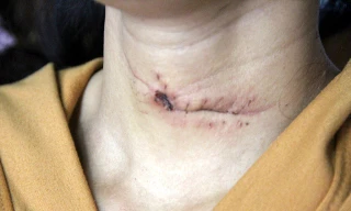 Hé lộ nguyên nhân vụ giết anh họ, cứa cổ hàng xóm tại Nghệ An