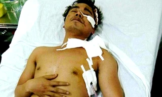 MC truyền hình bị cướp đâm trọng thương vào nửa đêm