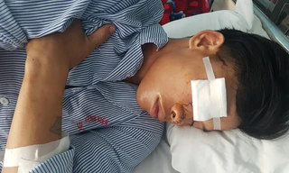 Đinh Luyên đang được điều trị tại Bệnh viện Hữu nghị Việt Nam Cuba Đồng Hới