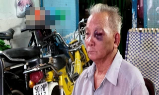 Người dân bị nhóm côn đồ đánh bị thương