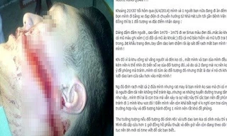 Hình ảnh nam sinh bị rạch mặt đưa chia sẻ trên Facebook cá nhân