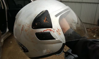 Mũ bảo hiểm của nhà báo Đỗ Doãn Hoàng dính máu khi bị hành hung