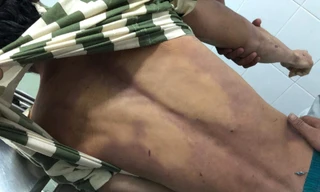 Bị đánh tại nhà tạm giữ, nam thanh niên tử vong