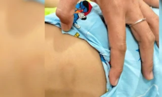 Bình Thuận: Đình chỉ hoạt động cơ sở giữ trẻ vượt quá số lượng quy định