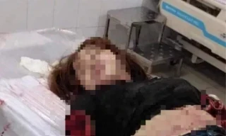 Nghi phạm khai nguồn cơn vác dao chém vợ lìa hai cánh tay 