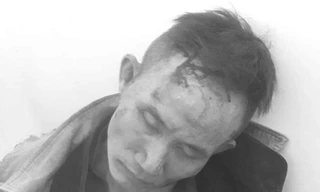 Dùng súng và lựu đạn cướp xe công an, bắn trả khi bị truy đuổi