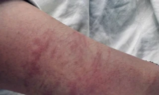  Khởi tố, tạm giam bác sĩ xâm hại tình dục bệnh nhân tại phòng khám