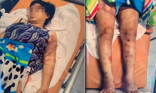 Lời khai rợn người của kẻ chủ mưu tra tấn thai phụ như thời trung cổ