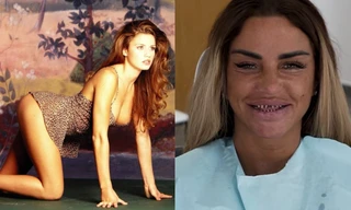 'Thảm họa dao kéo' nước Anh thừa nhận tu sửa vòng một tới 12 lần