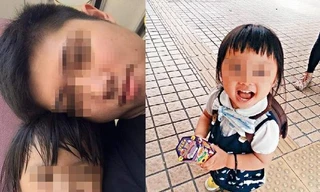 Bé 5 tuổi bị mẹ kế hành hạ khiến cơ thể kiệt quệ như người già làm cộng đồng mạng phẫn nộ