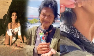 Thúy Nga hoảng hốt phát hiện ca sĩ Kim Ngân sống lang thang tại Mỹ bị cắt một bên tai