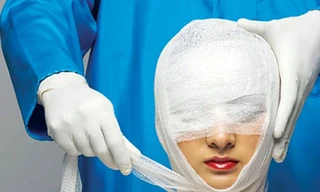 Mặt trái của phẫu thuật thẩm mỹ